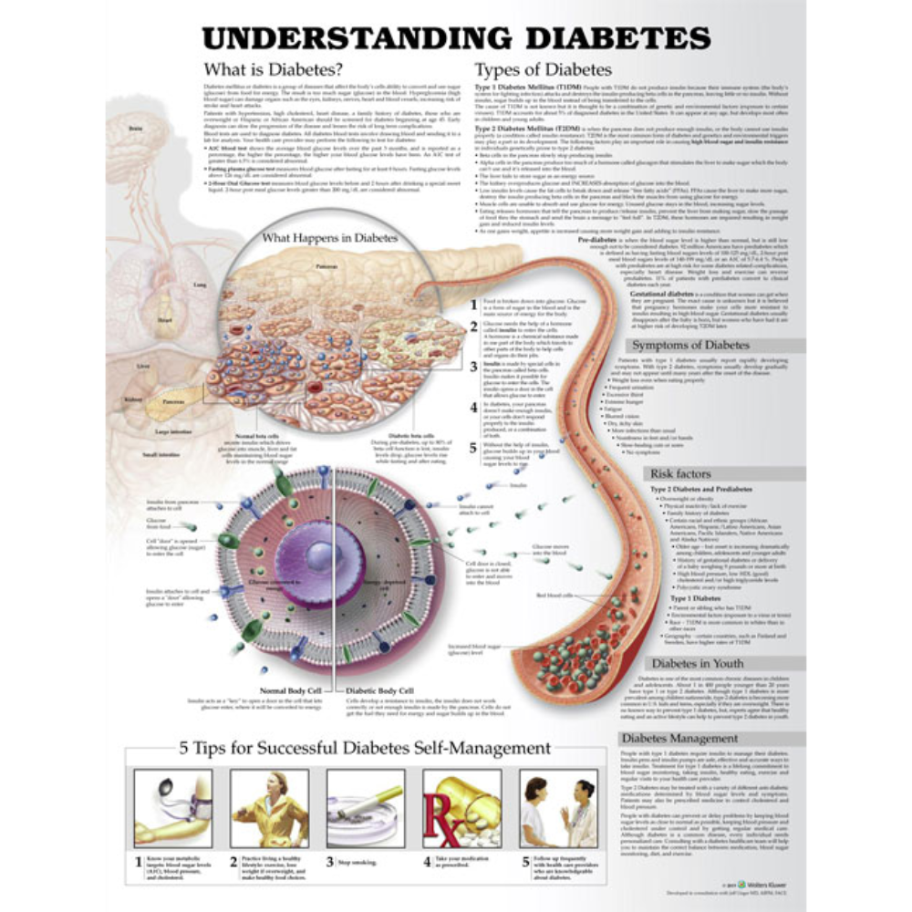 Understanding Diabetes Anatomical Chart