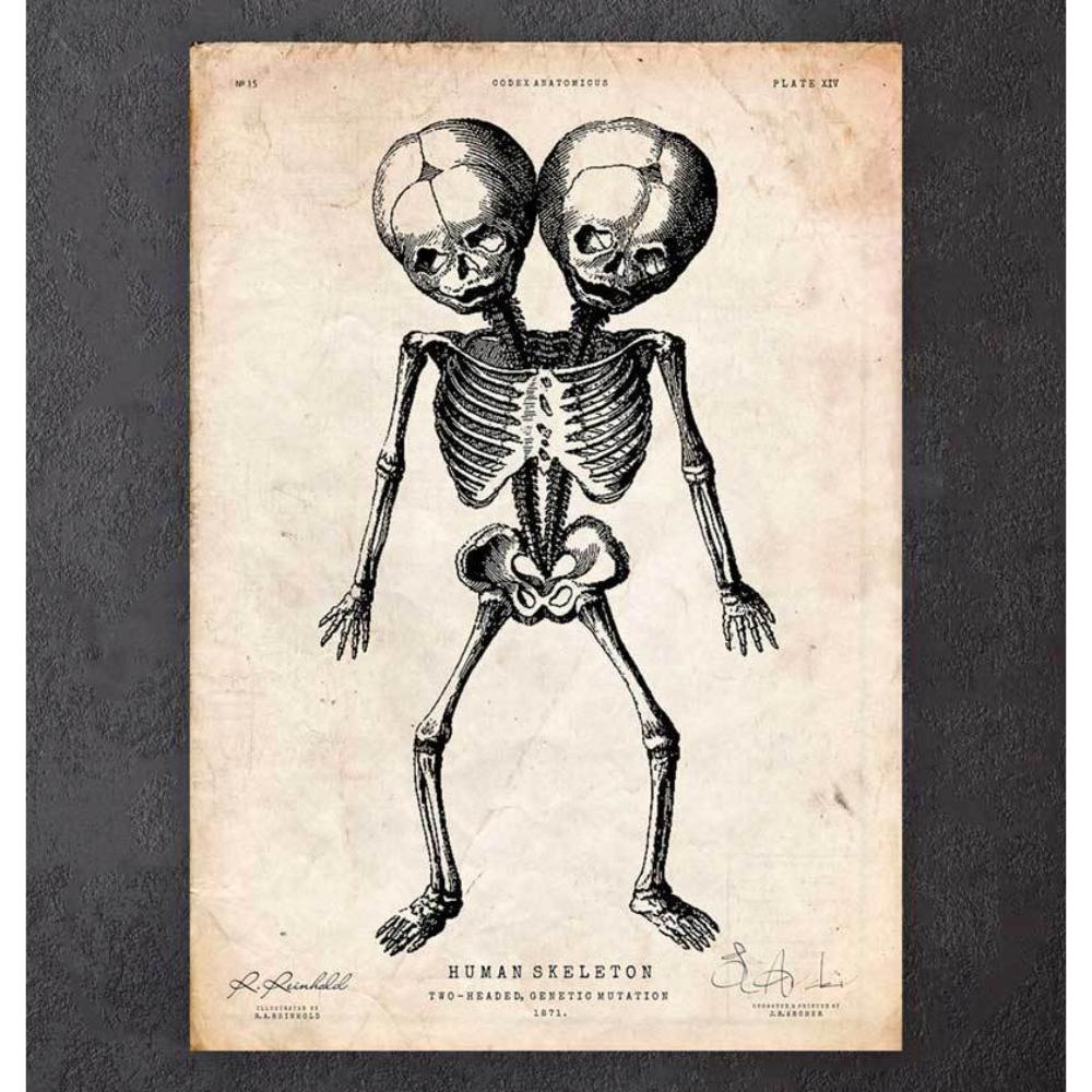 TwoHeaded Skeleton Print
