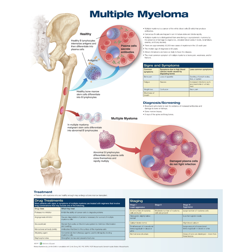 Multiple Myeloma