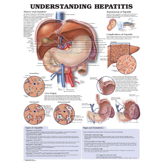 Understanding Hepatitis Anatomical Chart