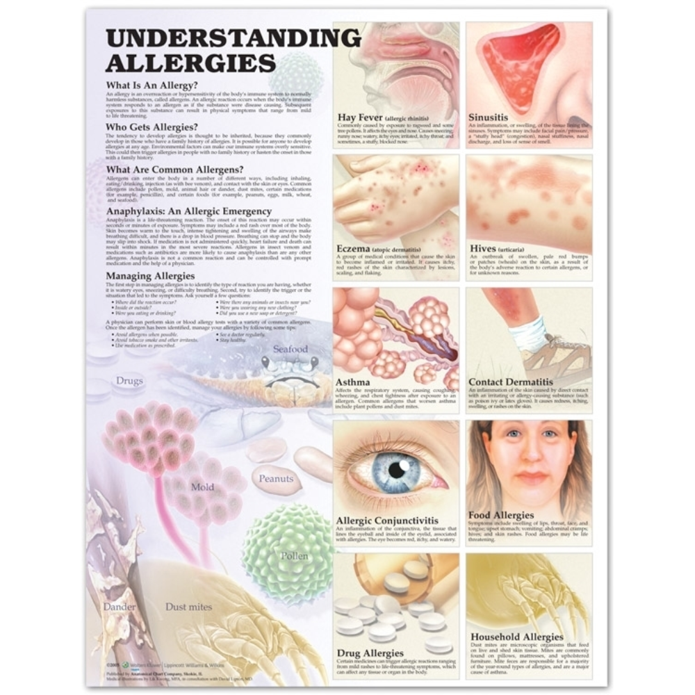 Understanding Allergies Anatomical Chart