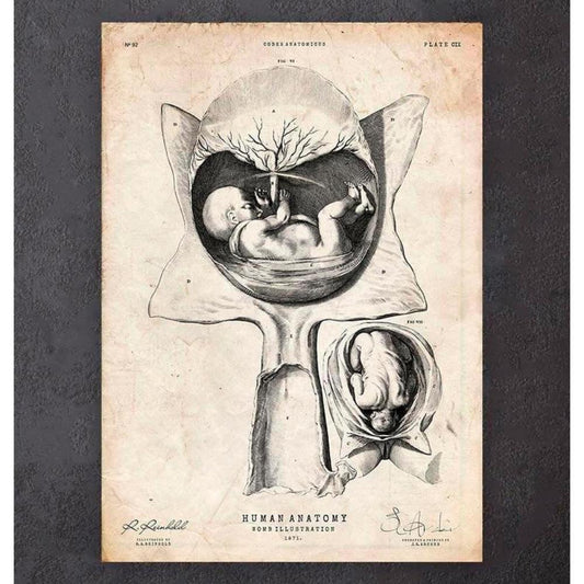 Fetus In A Womb Anatomy Print IV