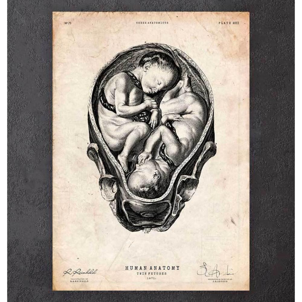 Fetus In A Womb Anatomy Print II