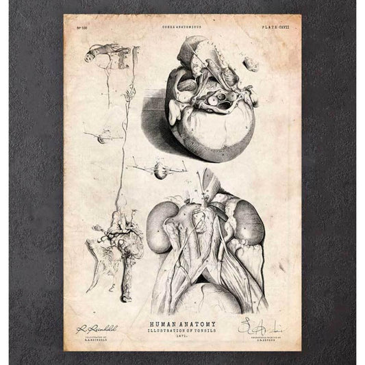 Tonsils Anatomy Print